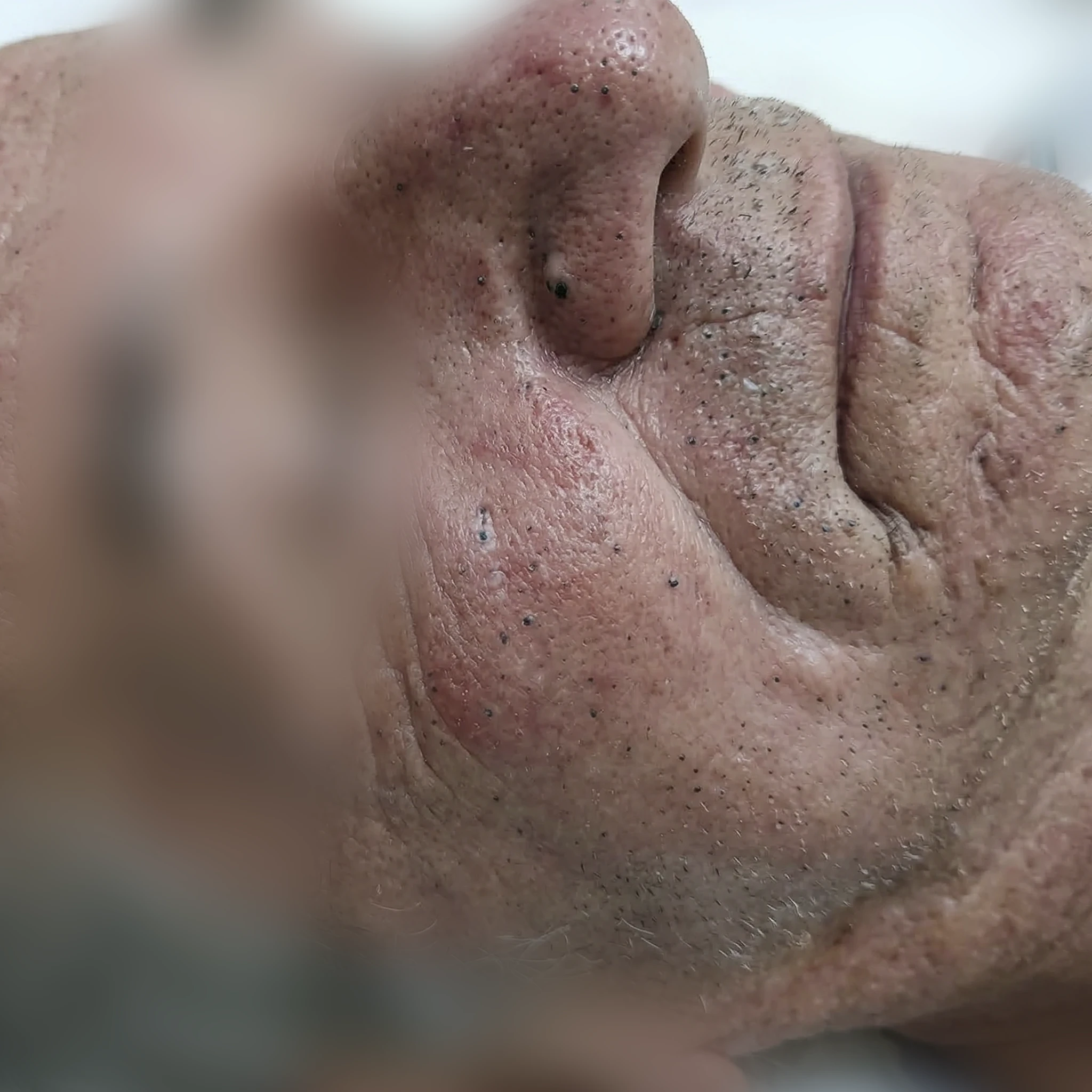 Transformação ANTES