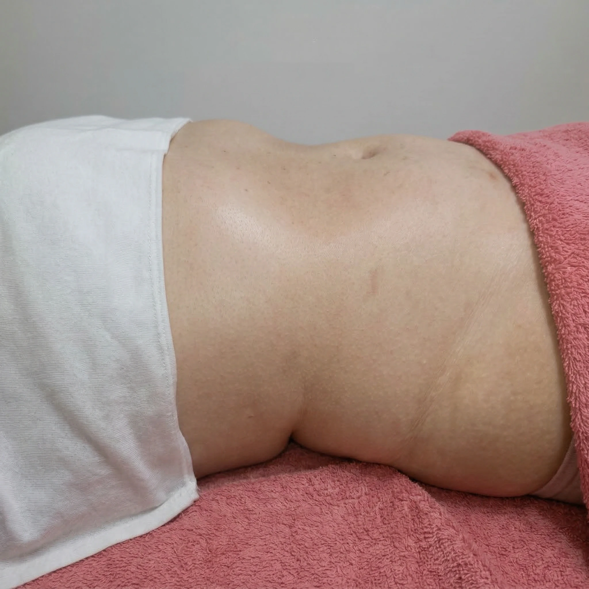 Transformação DEPOIS